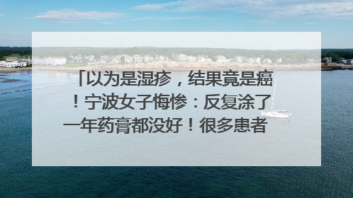 以为是湿疹，结果竟是癌！宁波女子悔惨：反复涂了一年药膏都没好！很多患者首诊都去了皮肤科